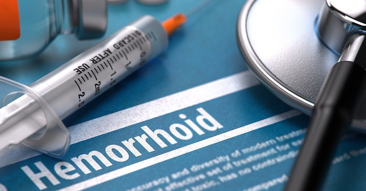 Hemorrhoid Banding Procedure