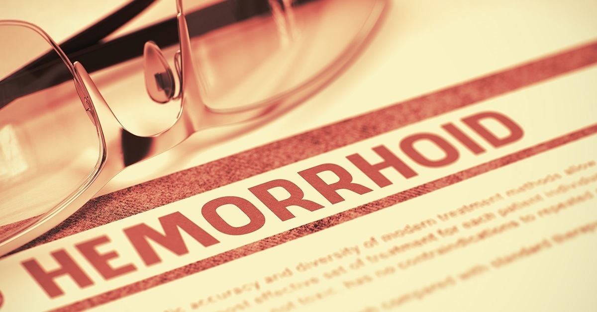 Hemorrhoid Treatment Guide Hemorrhoid Treatment Guide