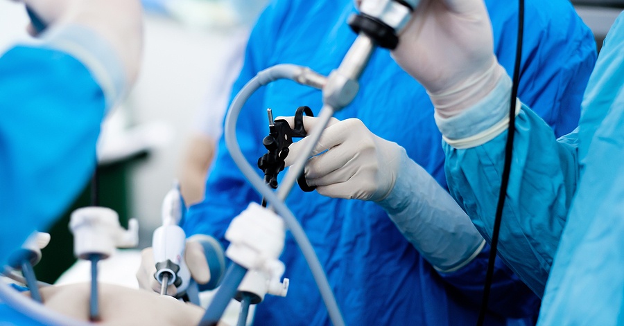 Anal Fistula